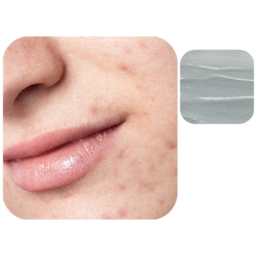Dark Spot Face Cream with Kojic Acid in einer 50-ml-Airless-Flasche mit einem Your-Brand-Here-Etikett